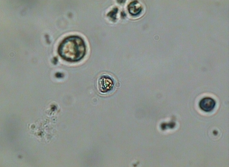 Dictyocha speculum
